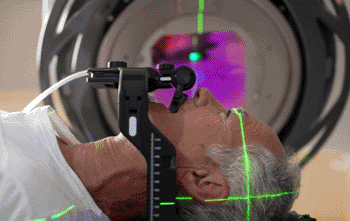 Imagen: El colimador multihoja Agility (MLC), un dispositivo de conformación de rayo integrado en la cabeza de un acelerador lineal (linac) para tratar el cáncer (Fotografía cortesía de Elekta).